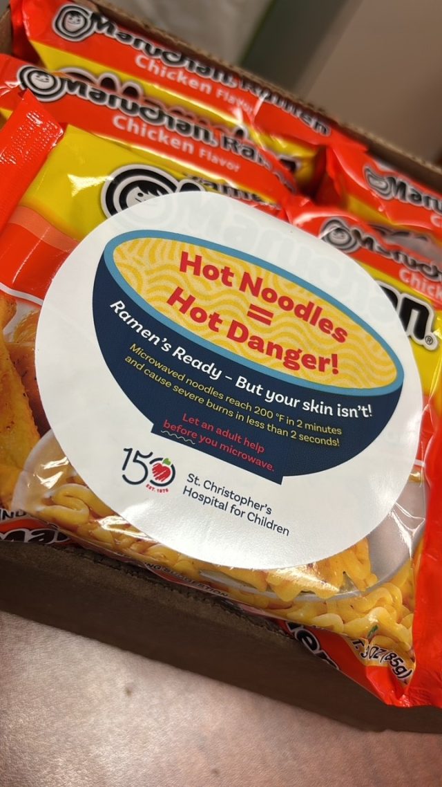 PICU/Burn-Ramen noodles to prevent burns.